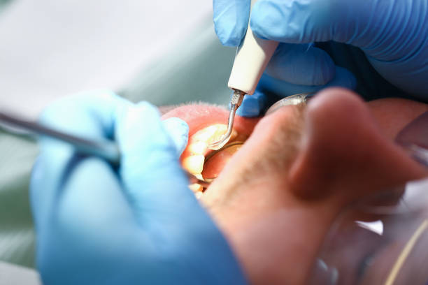 Best Emergency Cosmetic Dentistry (e.g., broken veneers) in Bridge City, LA